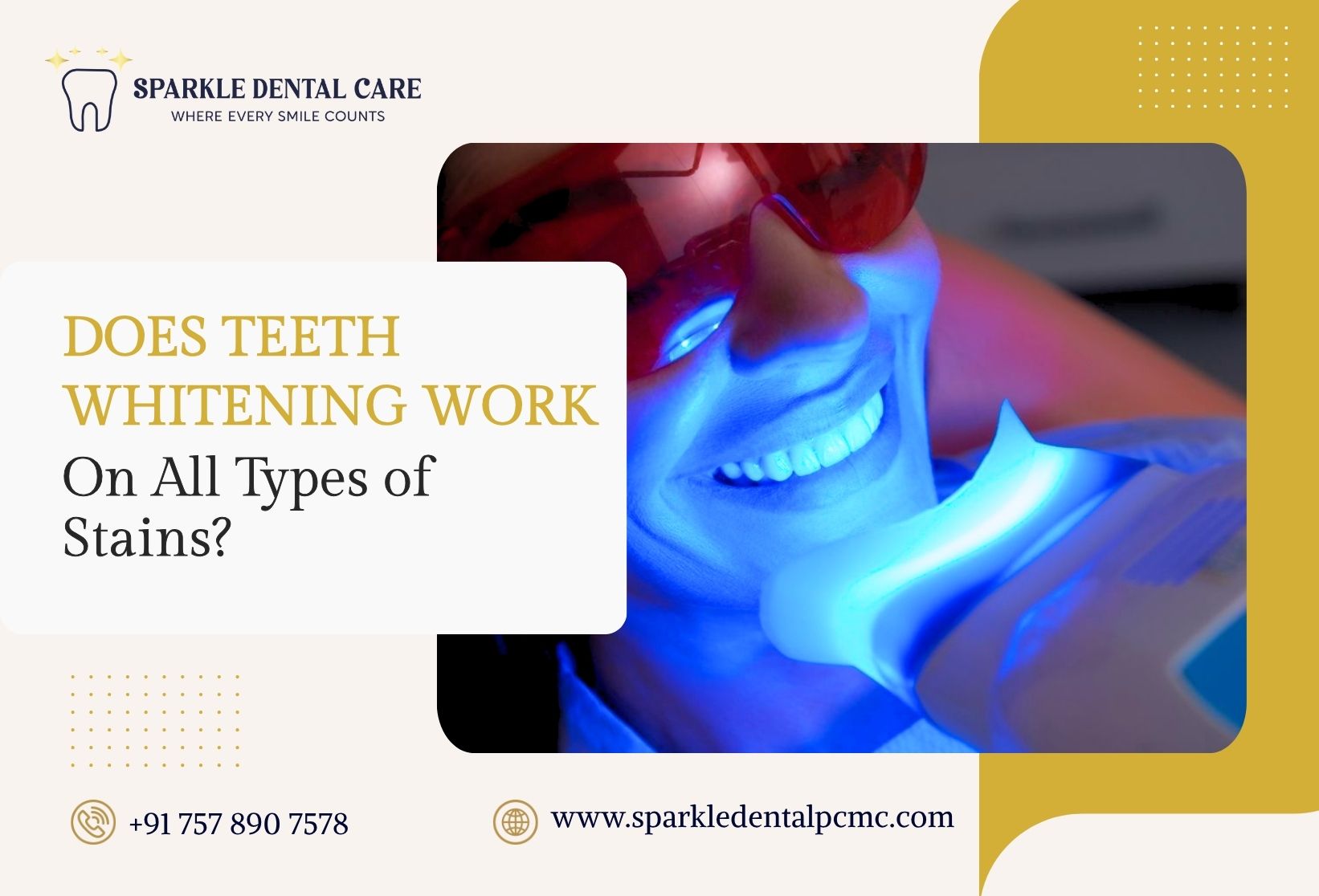 Does Teeth Whitening Work on All Types of Stains?